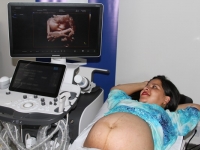 Sonnar Day Imagem 2017