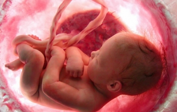 Descolamento de Placenta