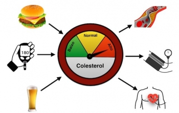 Colesterol Alto
