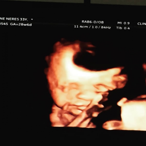 Ultrassonografia 3D/4D